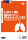 Cancers-broncho-pulmonaires-Du-diagnostic-au-suivi_large_vignette_publication